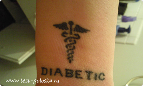 Татуировка у диабетика