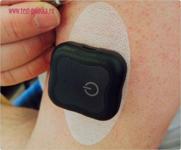 Новый сенсор для постоянного мониторинга уровня сахара в крови