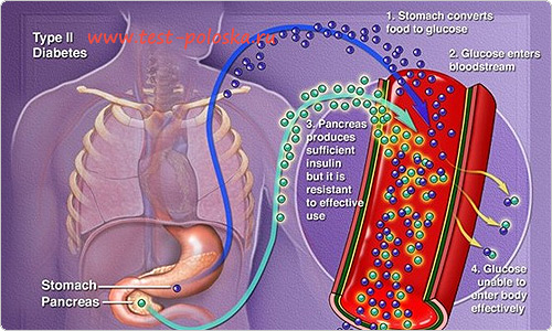 Как можно вылечить сахарный диабет