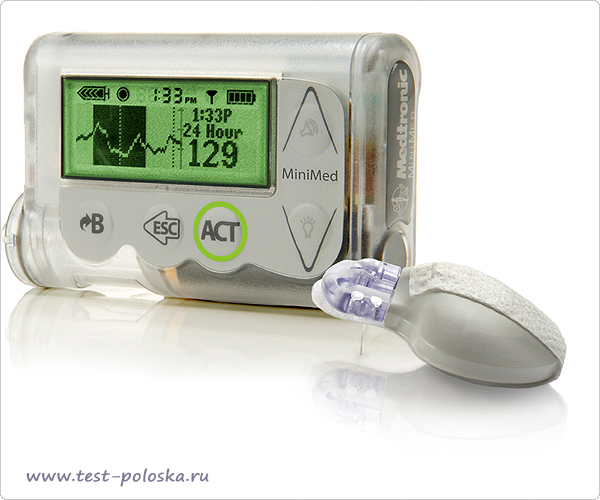 Разработка полностью автоматизированной инсулиновой помпы medtronic 530g