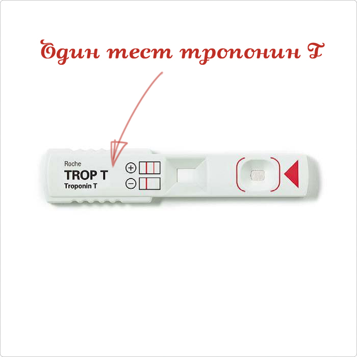 Тест ТРОП Т Сенситив TROP T Sensitive купить инфаркт миокарда цена отзывы