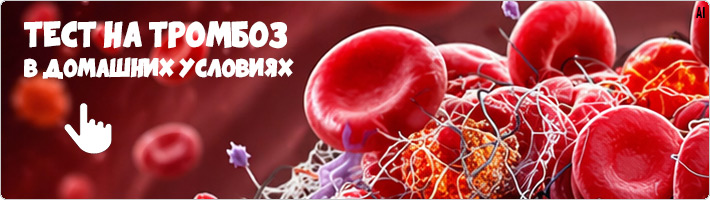 Заказать тест на тромбоз в домашних условиях
